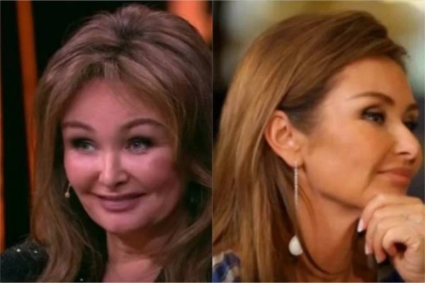 Елену Изаксон обвиняют в чрезмерном злоупотреблении пластикой Фотоколлаж: Владтайм